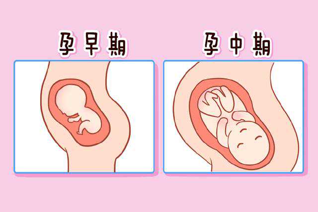 子宫下垂的养护与注意点